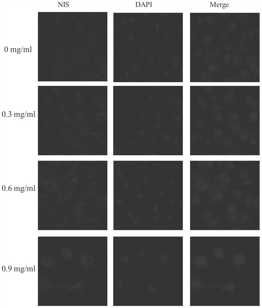 Application of total glucosides of paeony in the preparation of drugs for treating thyroid cancer and improving the synergistic effect of tumor radiotherapy