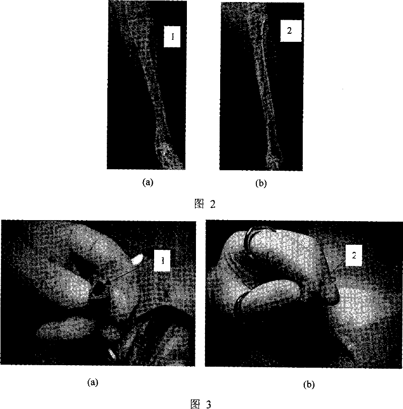 Novel orthopaedics medicaments carrier system and preparation thereof