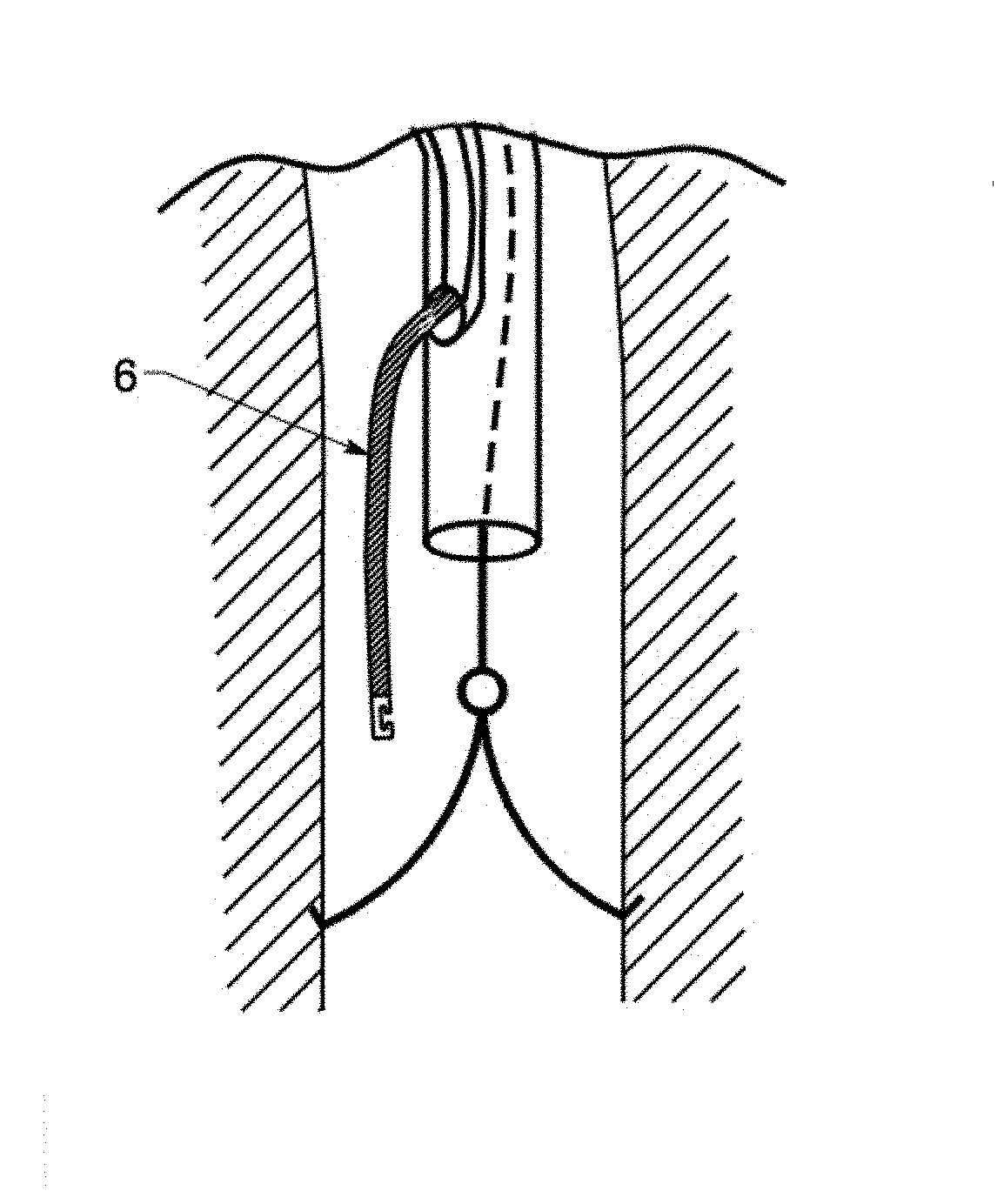 Multi lumen IVC filter retrieval device