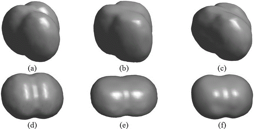 3D automatic glioma segmentation method combining Volume of Interest and GrowCut algorithm