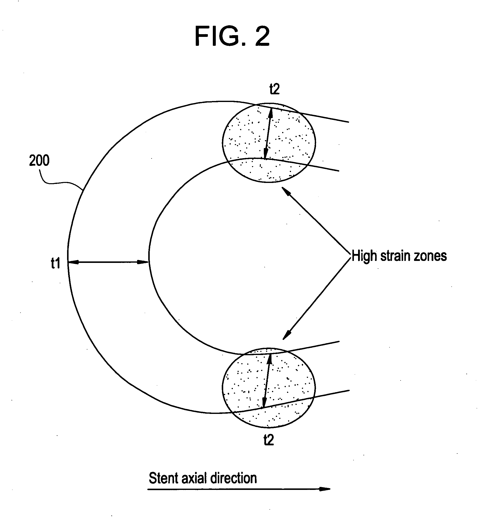 Implantable device formed from polymer blends having modified molecular structures