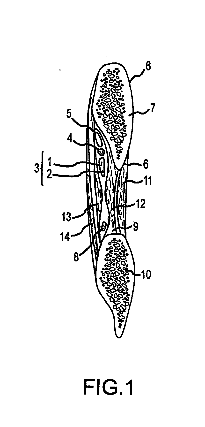 Thoracic retractors and methods