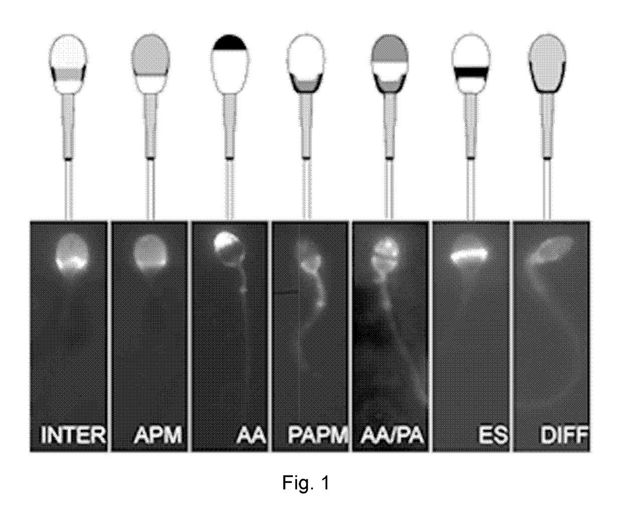 Identifying status of male fertility by determining sperm capacitation