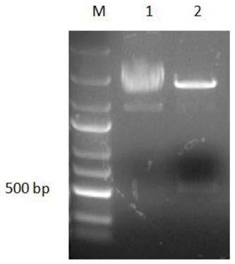 Hefang crucian Ferritin L gene, recombinant protein, preparation method and application and primers of recombinant protein