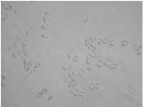 A method for isolating and culturing hepatic stellate cells of long-clawed gerbils