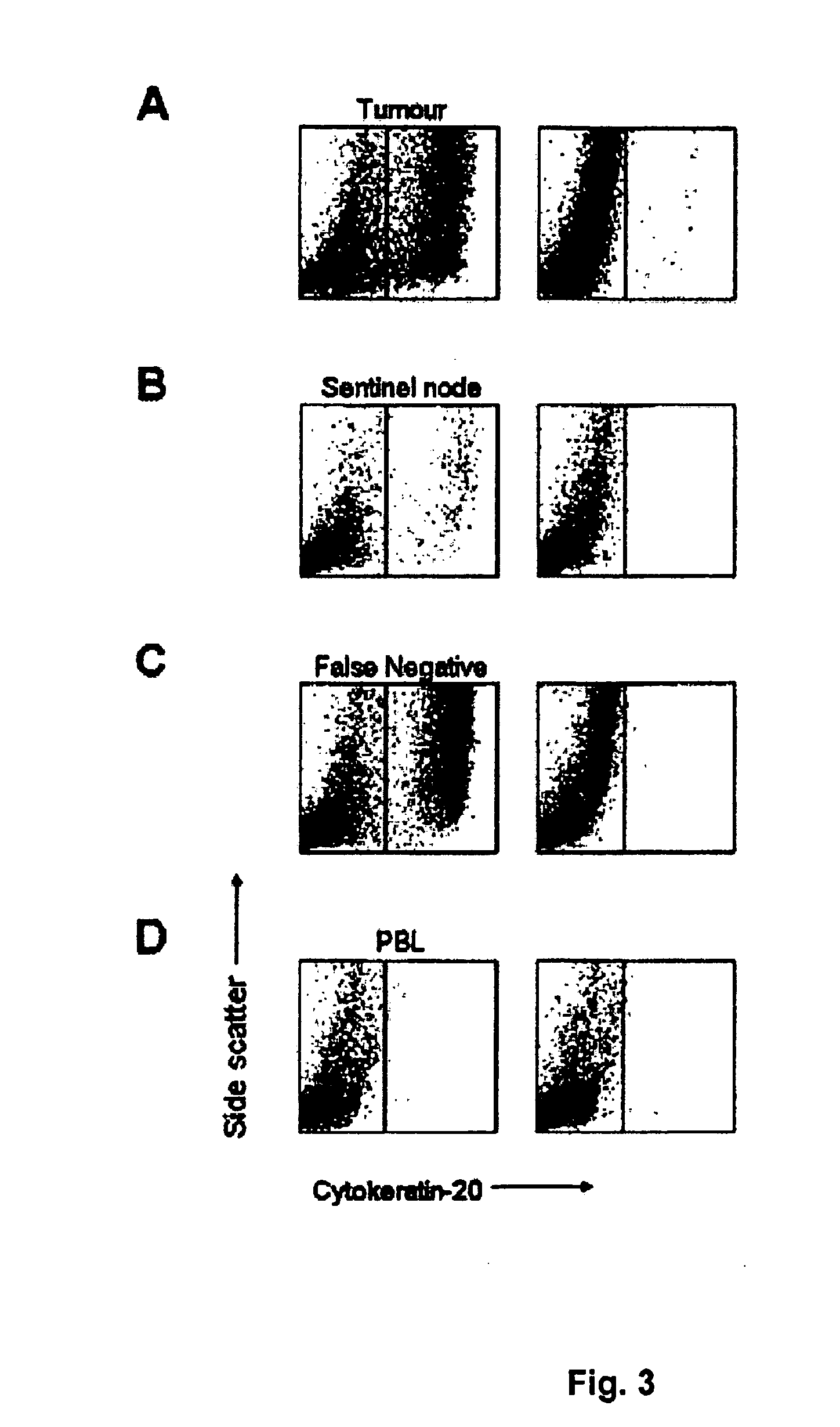 Method for Treating Urinary Bladder Cancer