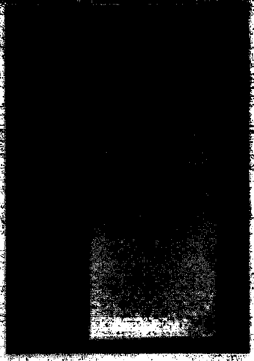 Tooth repair resin with X-ray radiation resistance and preparation method thereof