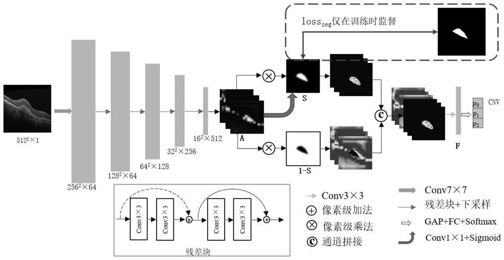 AMD lesion OCT image classification segmentation method and system based on bidirectional guide network