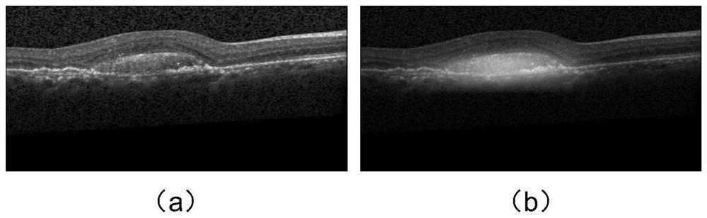 AMD lesion OCT image classification segmentation method and system based on bidirectional guide network