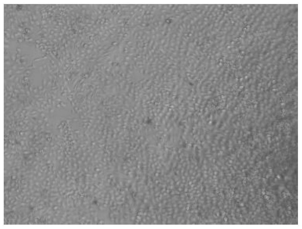 Preparation method and recovery method of decidua parietalis mesenchymal stem cells