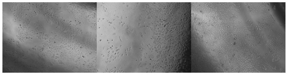 Preparation method and recovery method of decidua parietalis mesenchymal stem cells