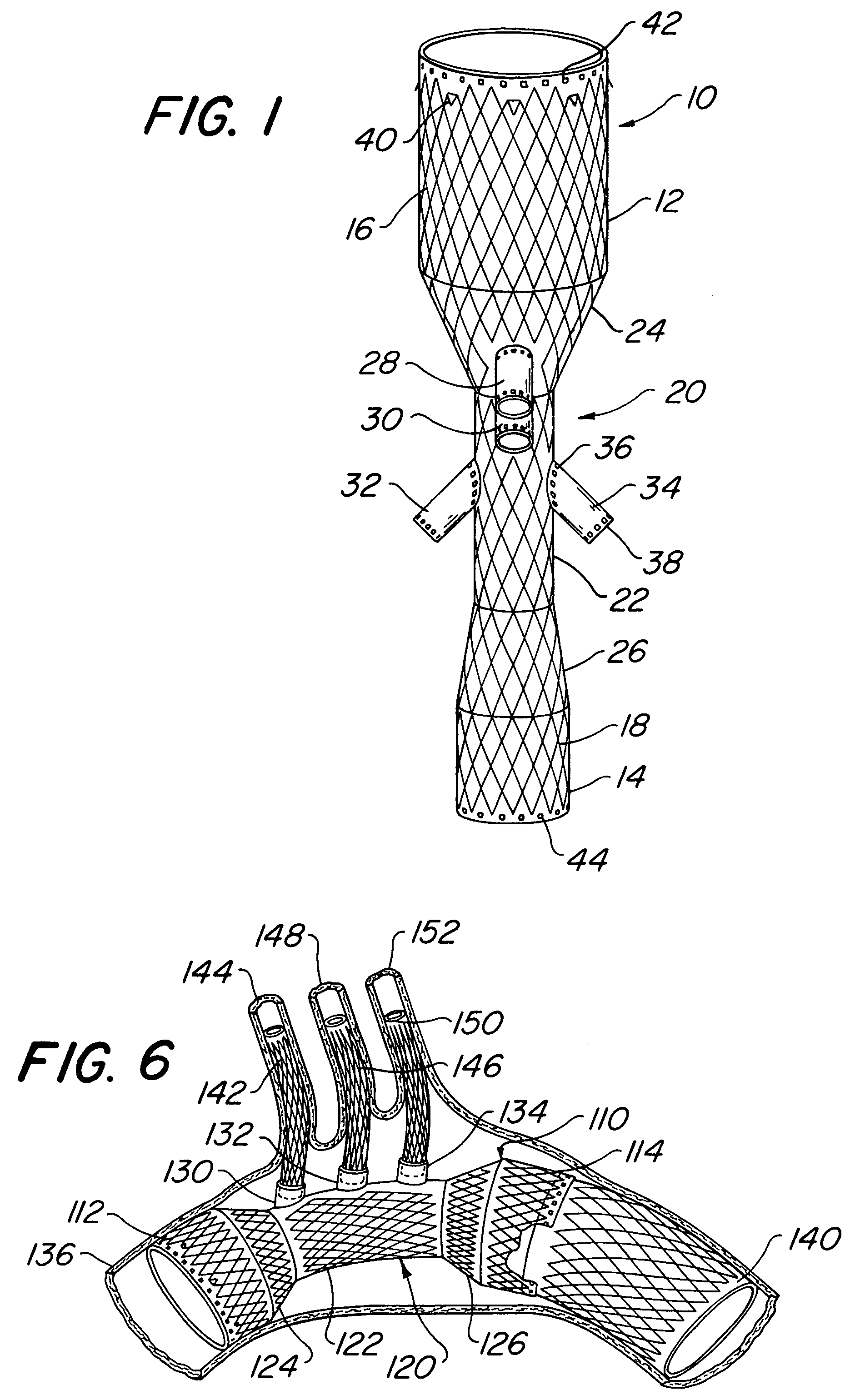 Endovascular prosthesis, system and method