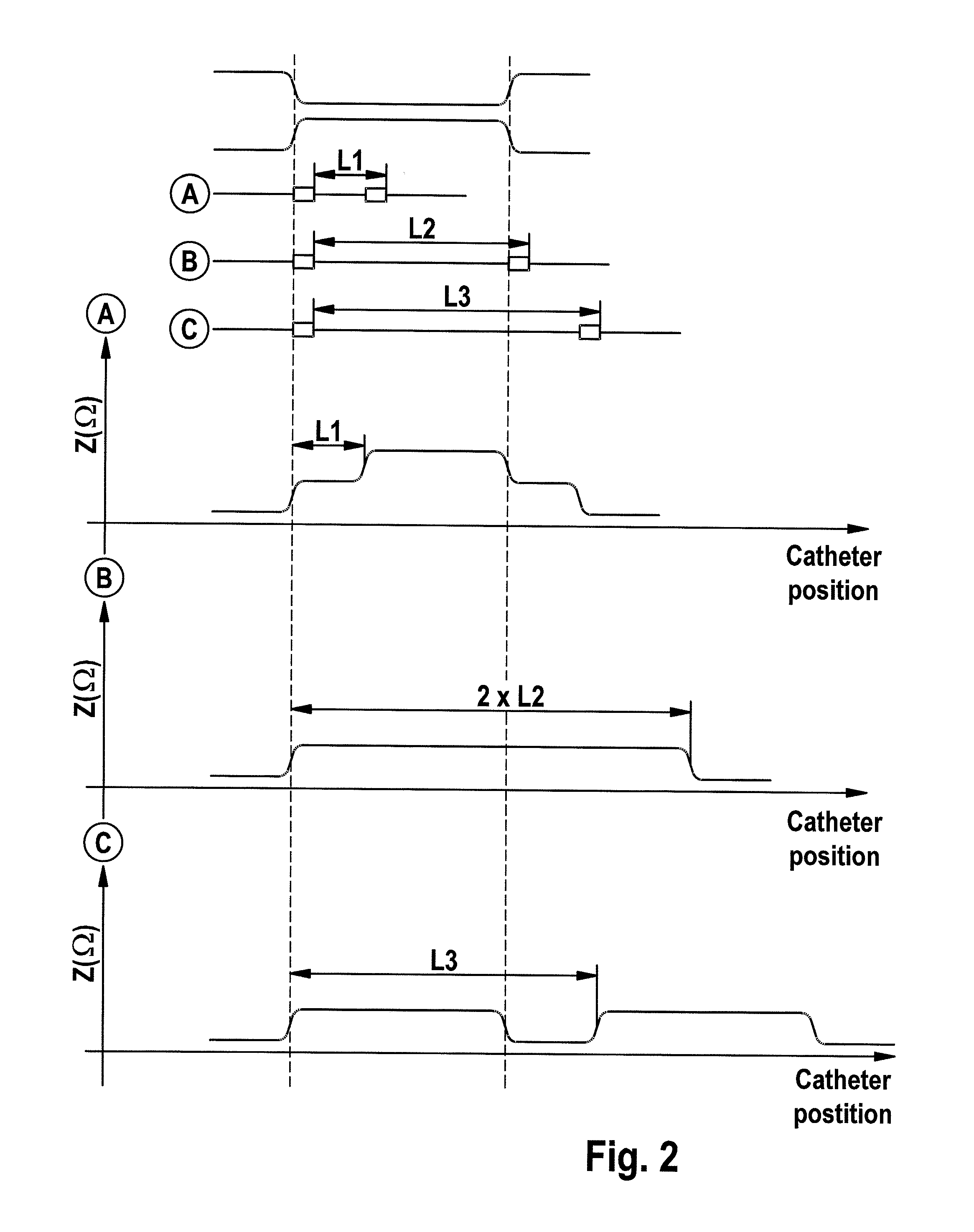 Positioning catheters using impedance measurement