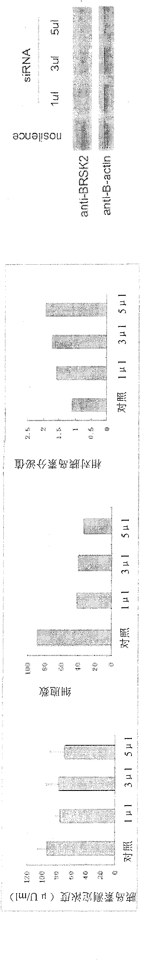 Nucleotide molecule SR5B2 and its application in preparation of antidiabetic medicine