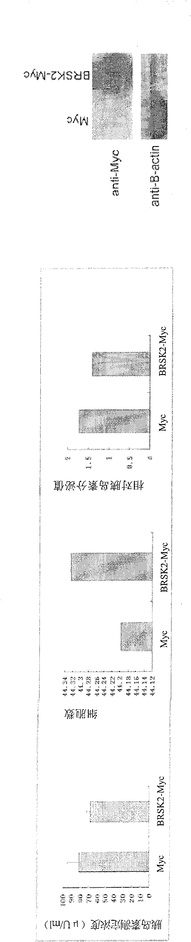 Nucleotide molecule SR5B2 and its application in preparation of antidiabetic medicine