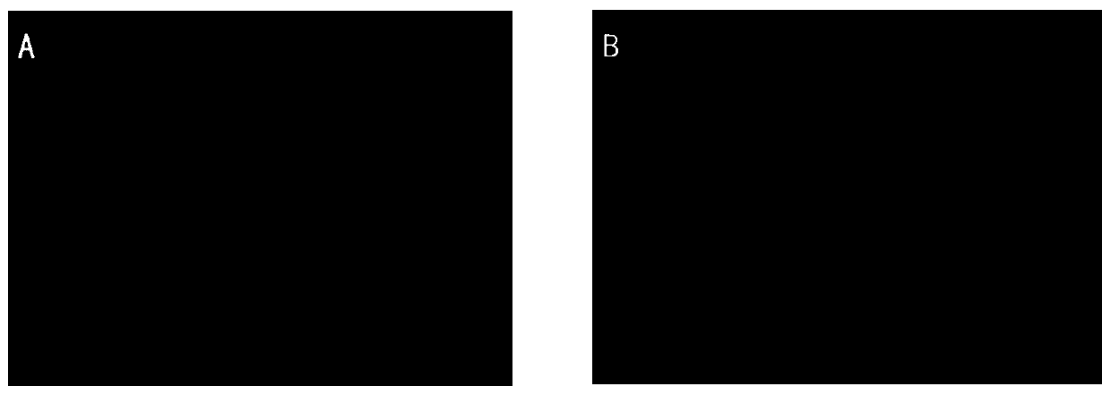 Application of Pulsatilla chinensis decoction in preparation of drugs for reducing TLR-4 gene expression in intestinal microvascular endothelial cells