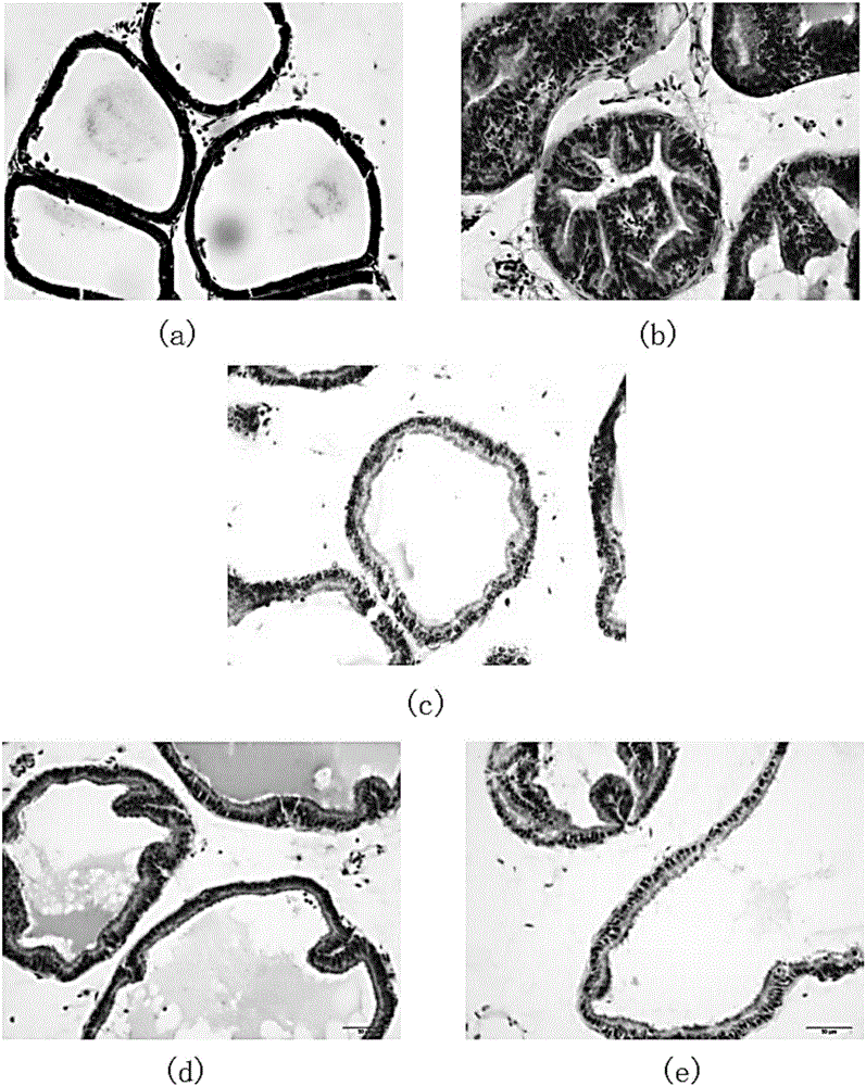 Application of antrodia cinnamomea in anti-benign prostatic hyperplasia medicines