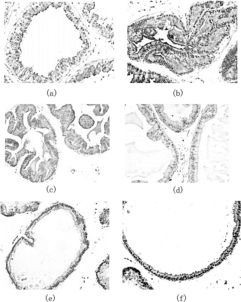 Application of antrodia cinnamomea in anti-benign prostatic hyperplasia medicines