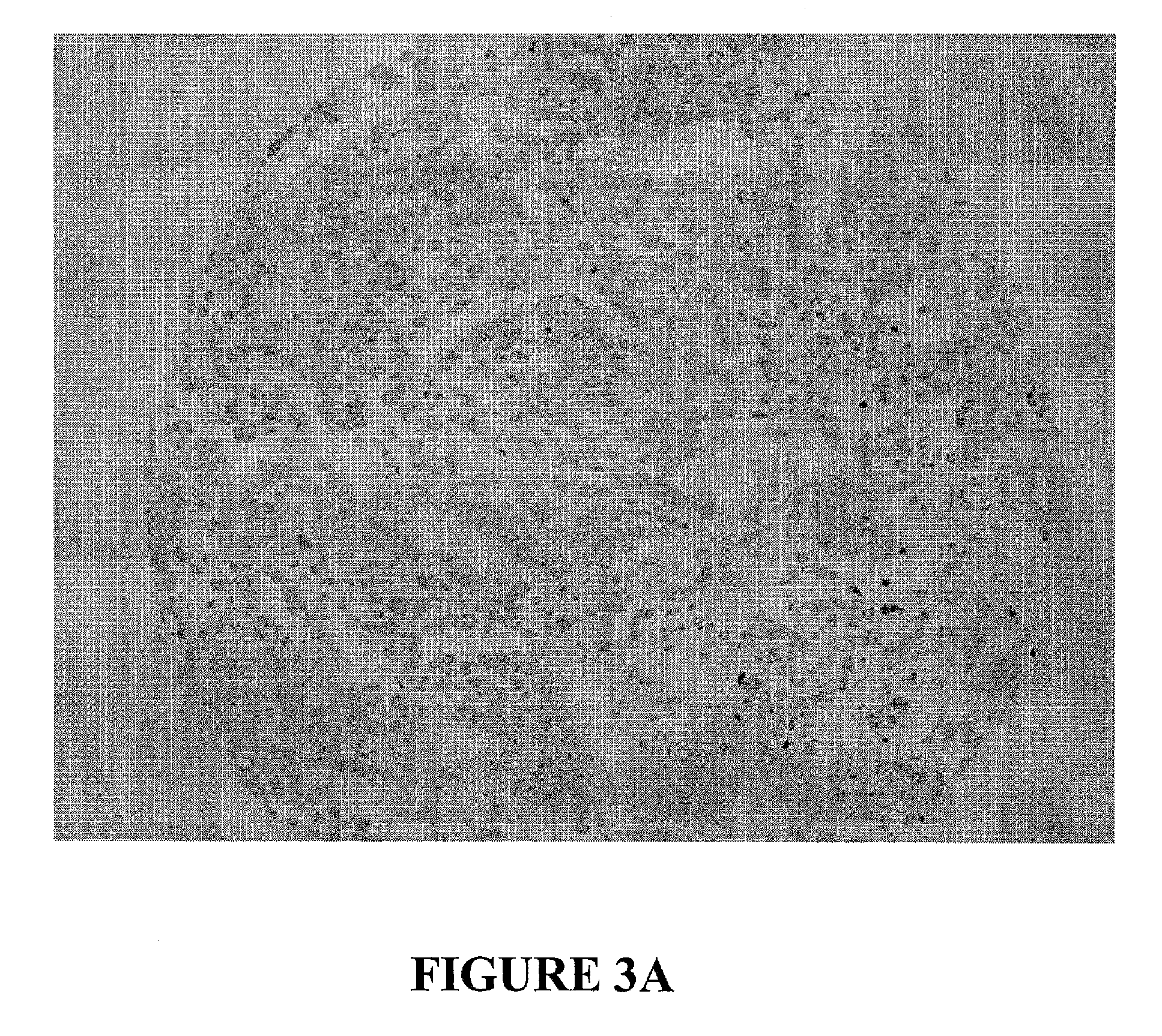 Antibodies to MUC16 and methods of use thereof