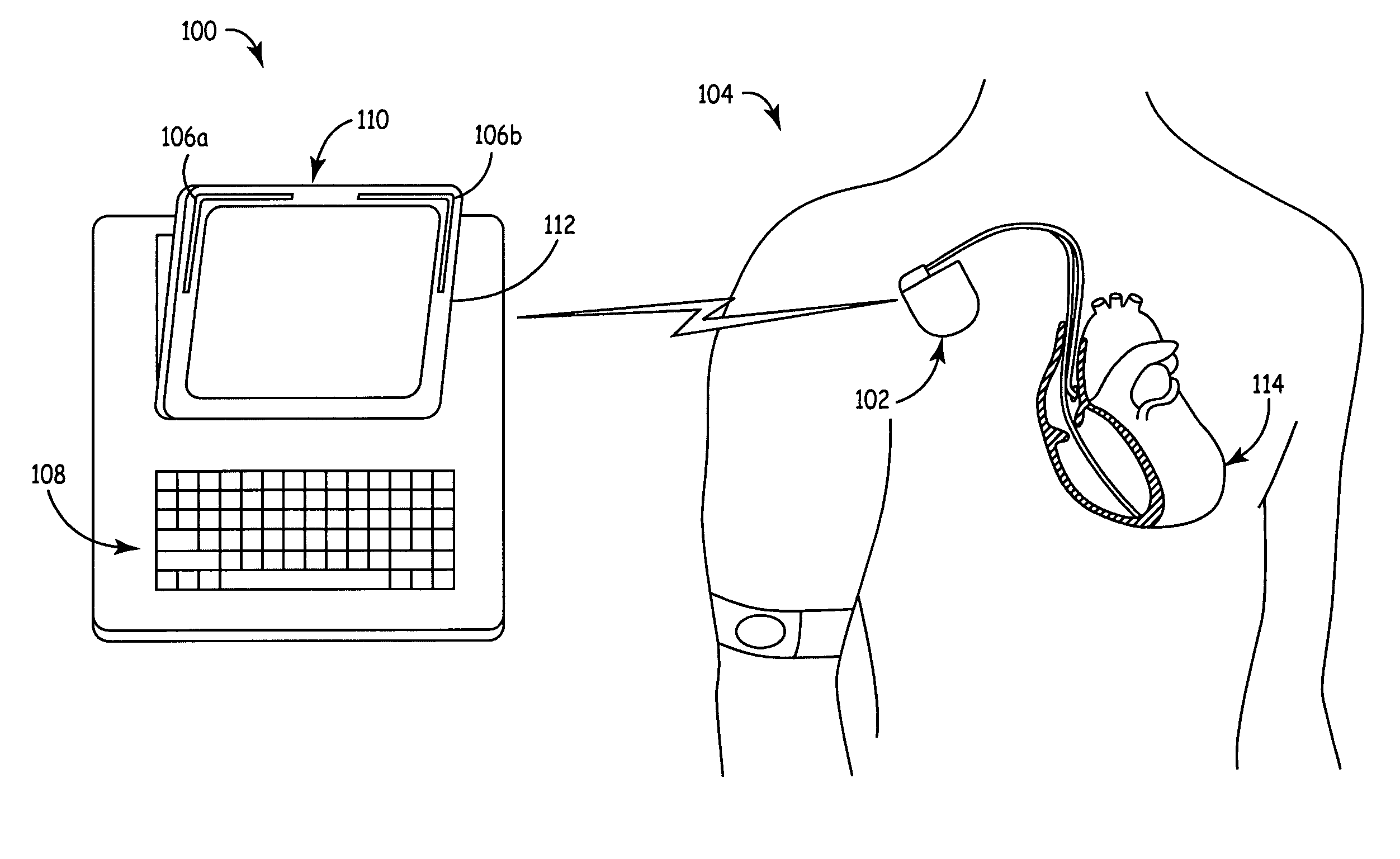 Compact conformal antenna for a medical telemetry system