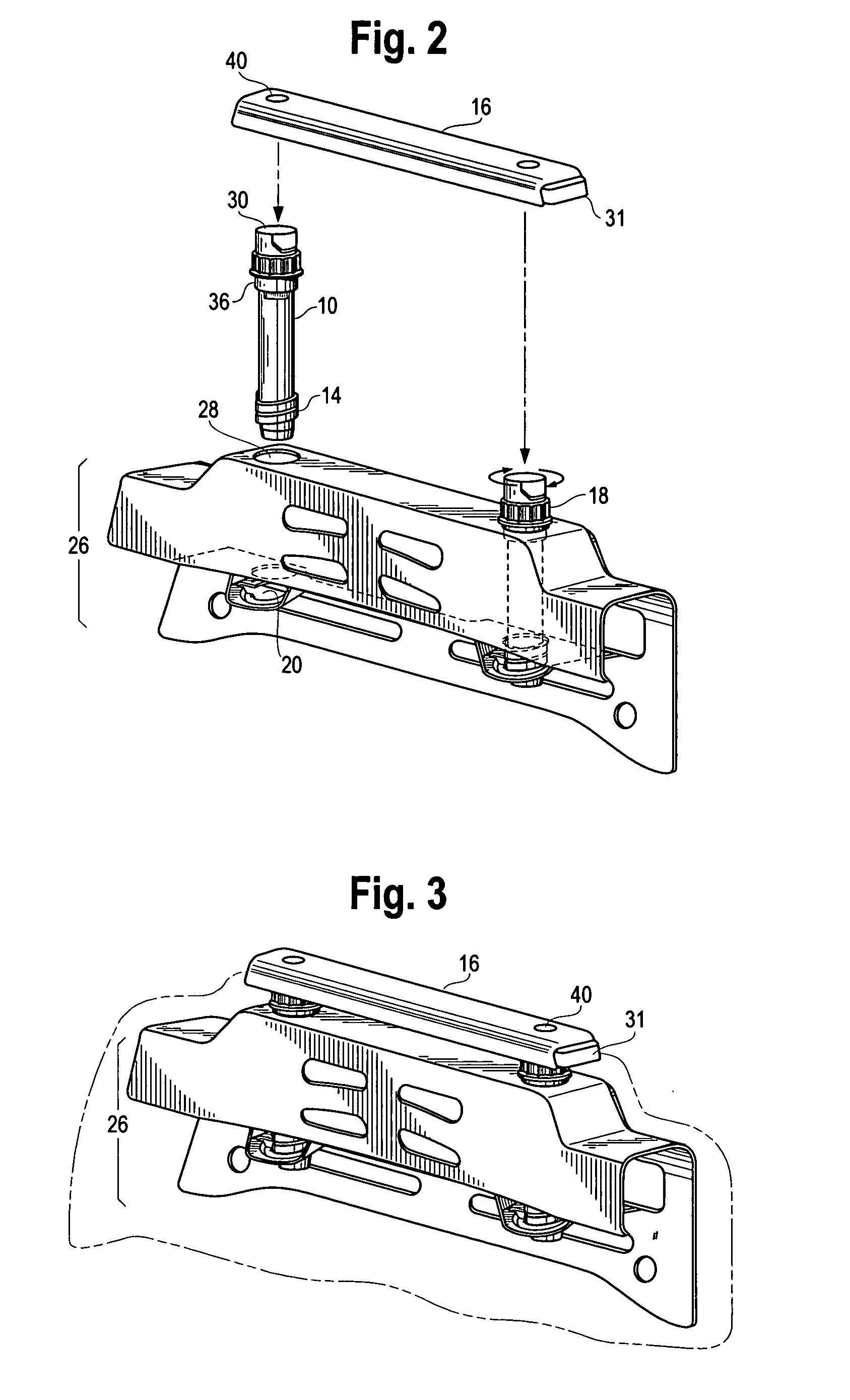 Helical head restraint guide