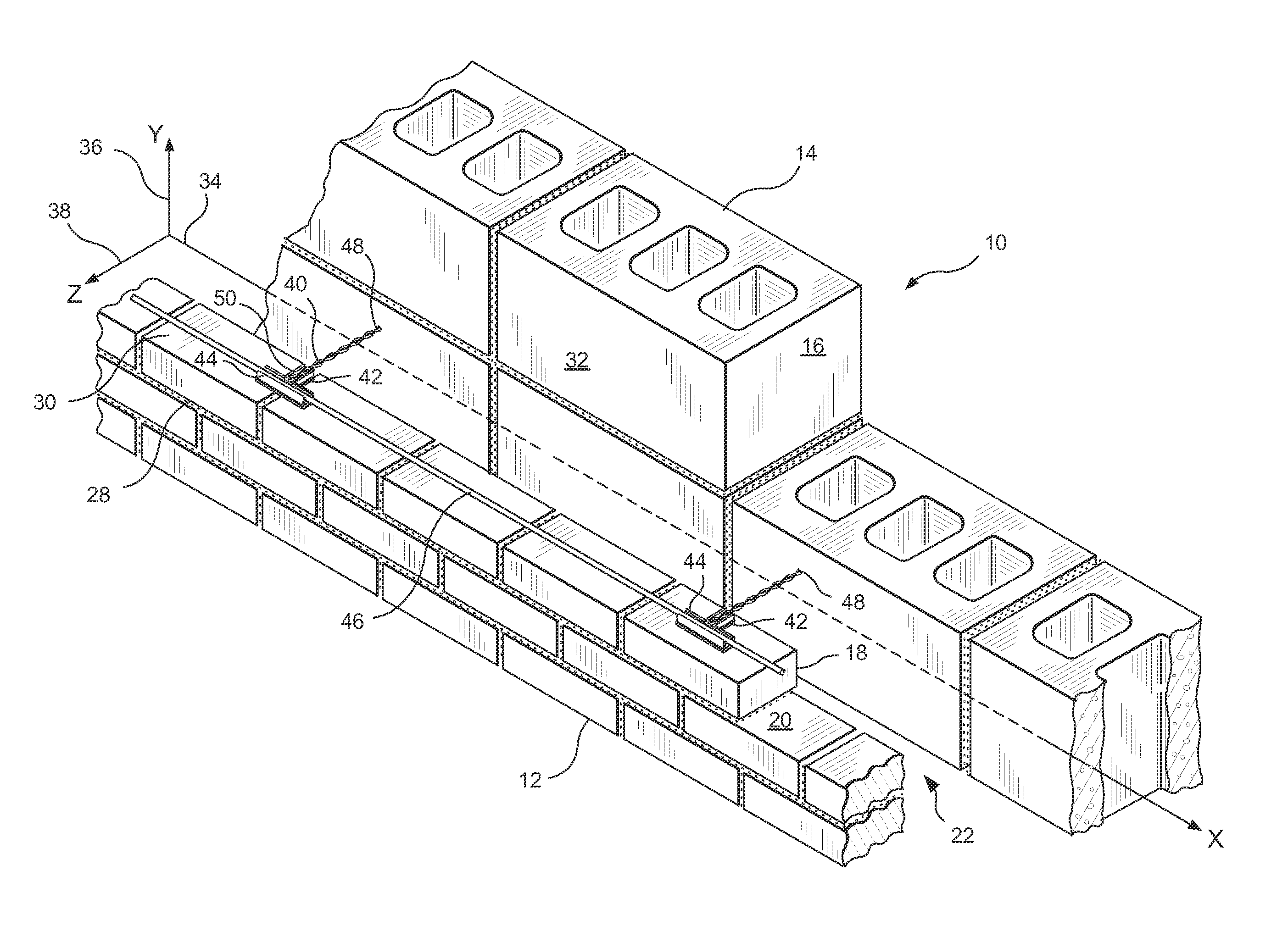 Restoration Anchoring System