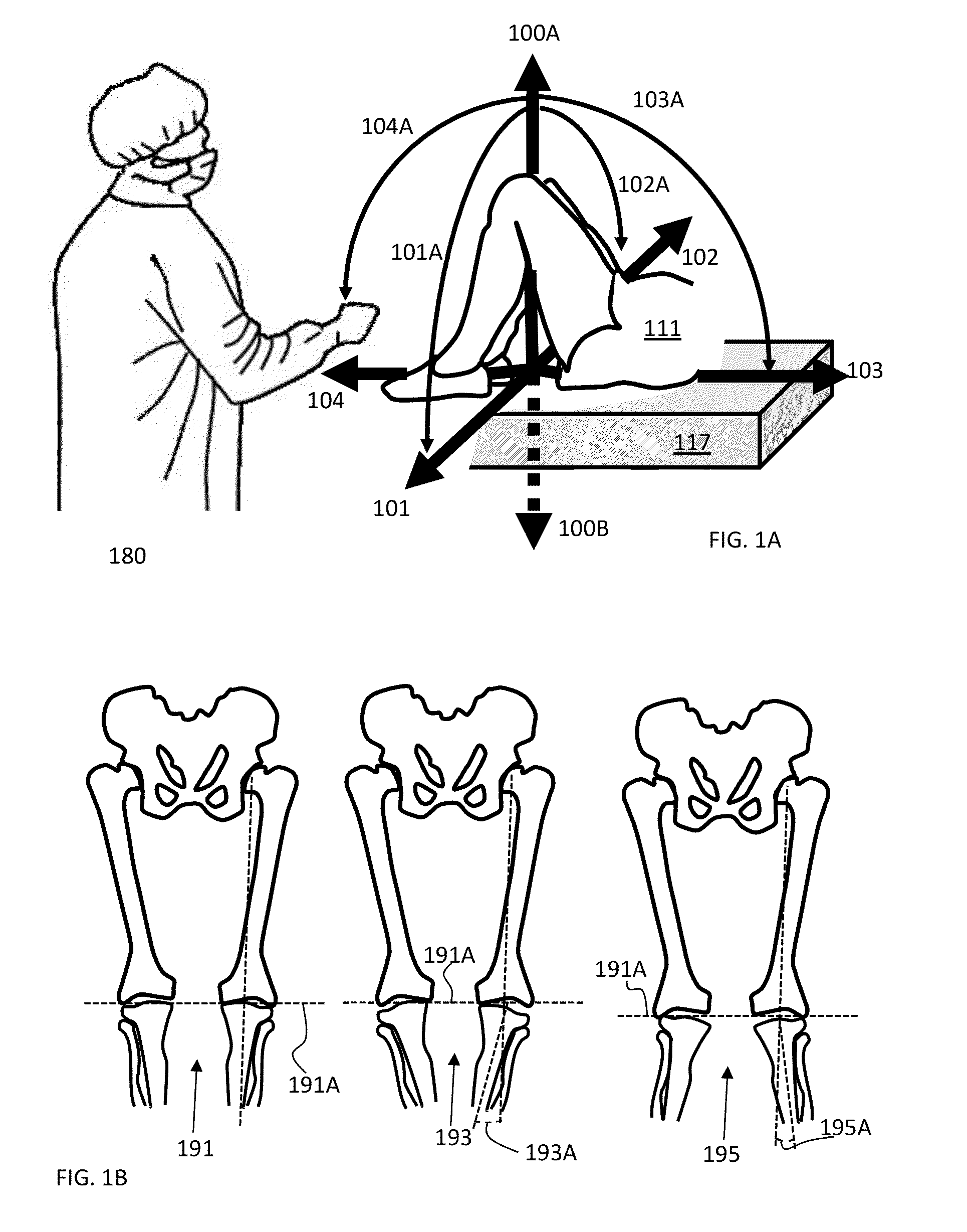 System and method for assessing, measuring, and correcting an anterior-posterior bone cut