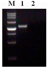 Echinococcus granulosus detection kit and application thereof