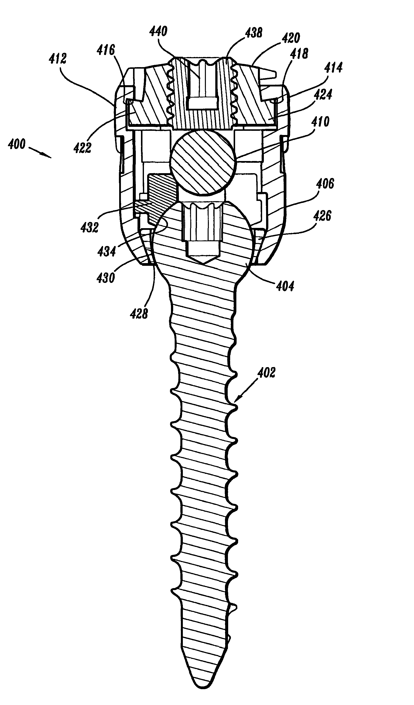 Orthopedic rod system