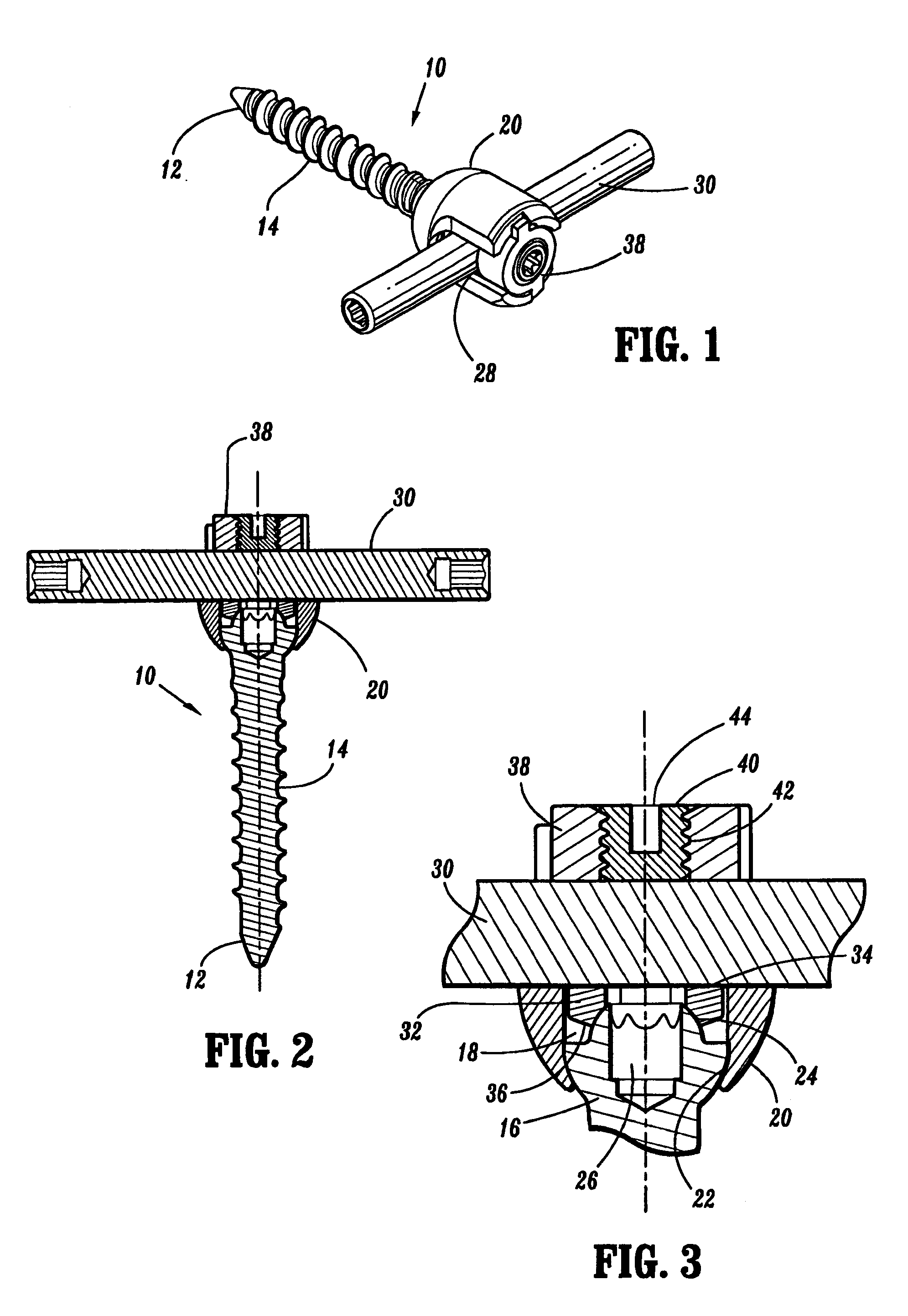 Orthopedic rod system