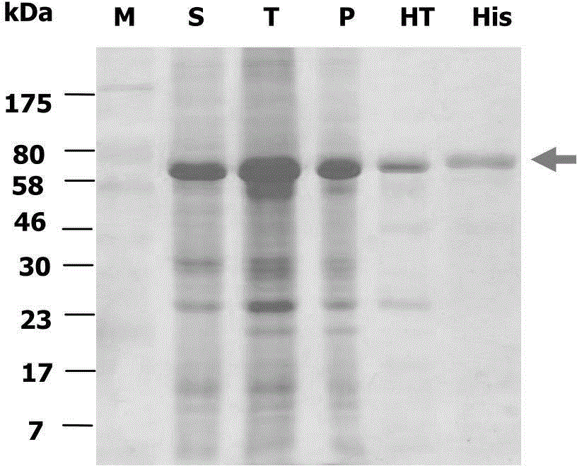 Cloning, expression and application of high temperature resistance isoamylase genes