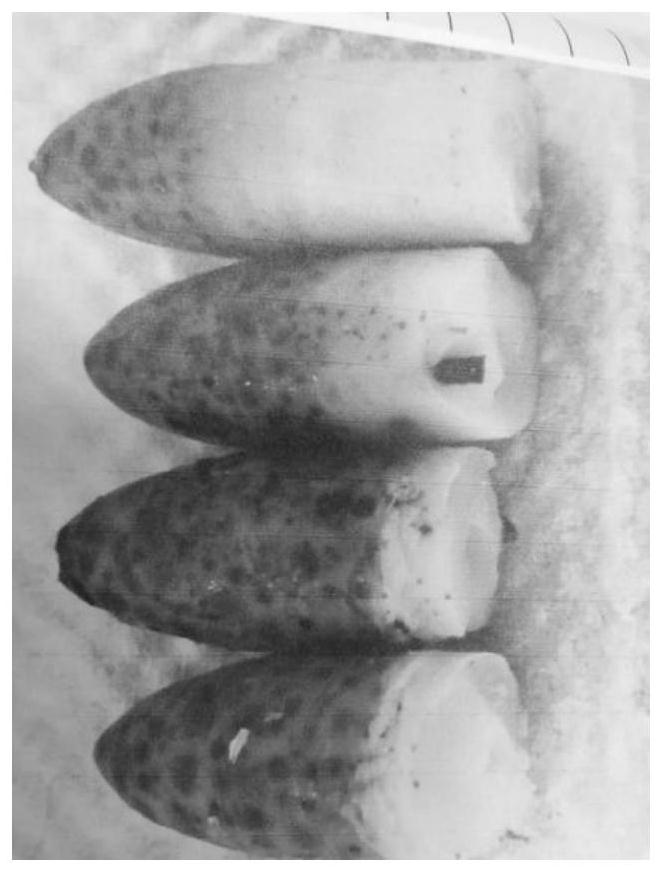 Traditional Chinese medicine compound for treating prostatitis and preparation method thereof