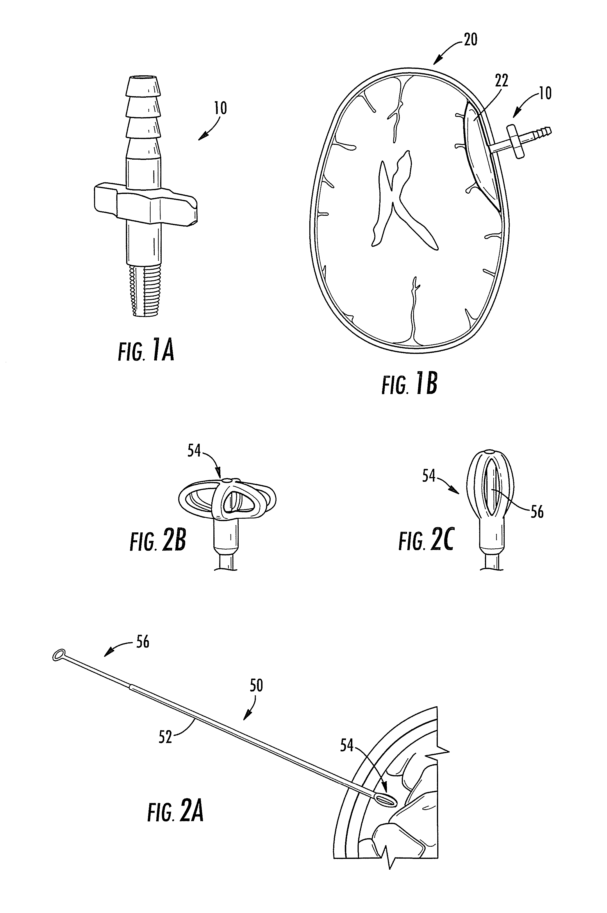 Subdural drainage catheter with flow restoration mechanism