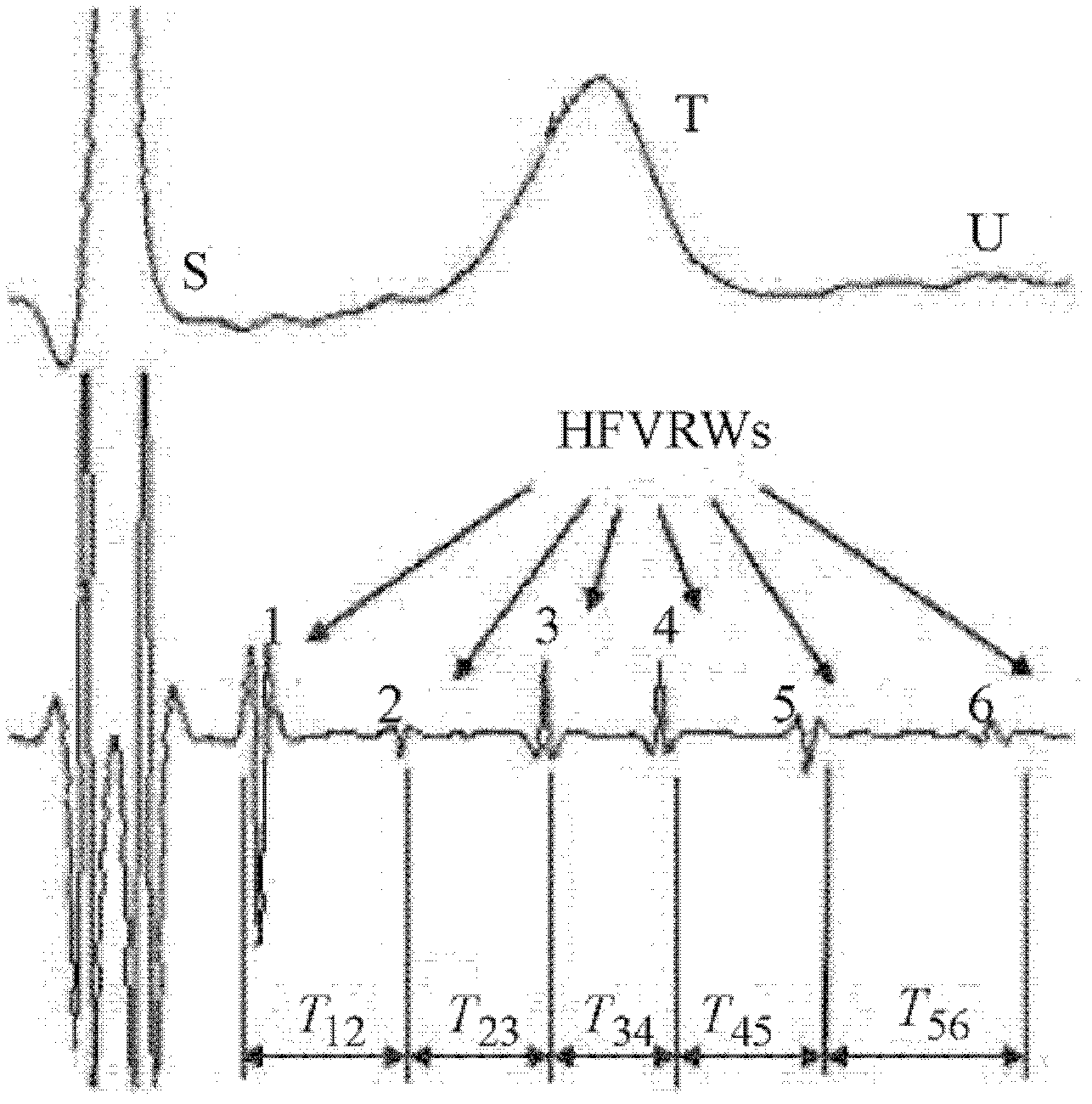 Ventricular repolarization high-frequency wave double-limb electrode detecting device