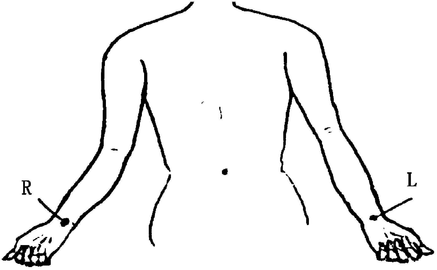 Ventricular repolarization high-frequency wave double-limb electrode detecting device