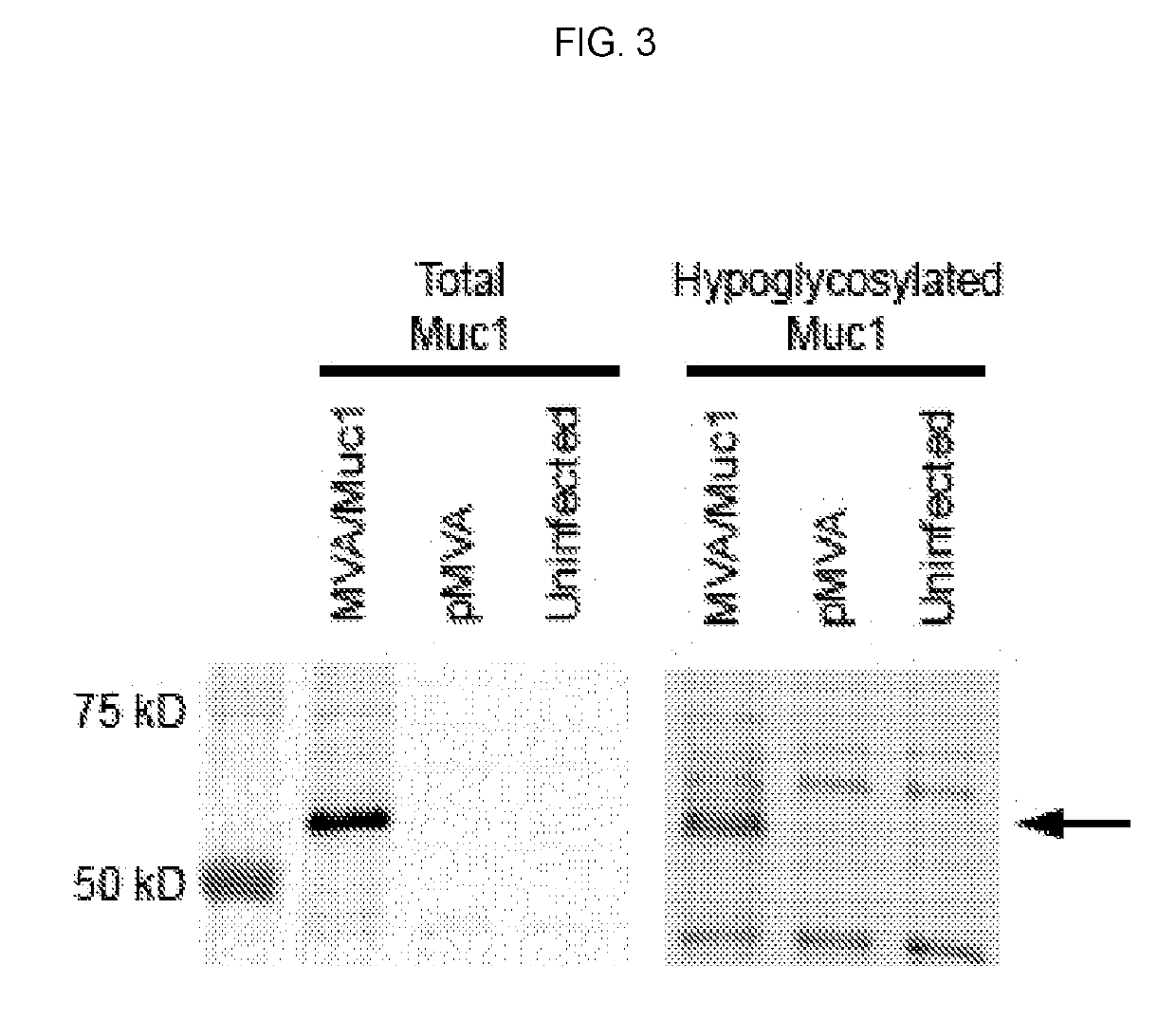 Compositions and Methods for Generating an Immune Response to a Tumor Associated Antigen