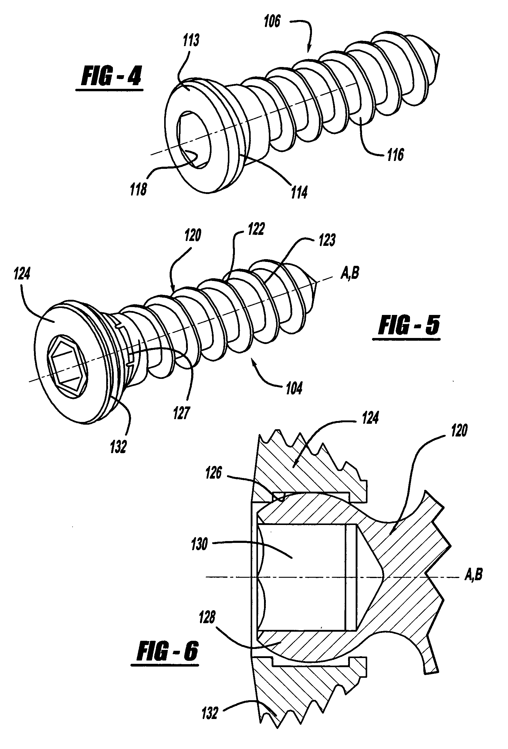 Bone fixation system