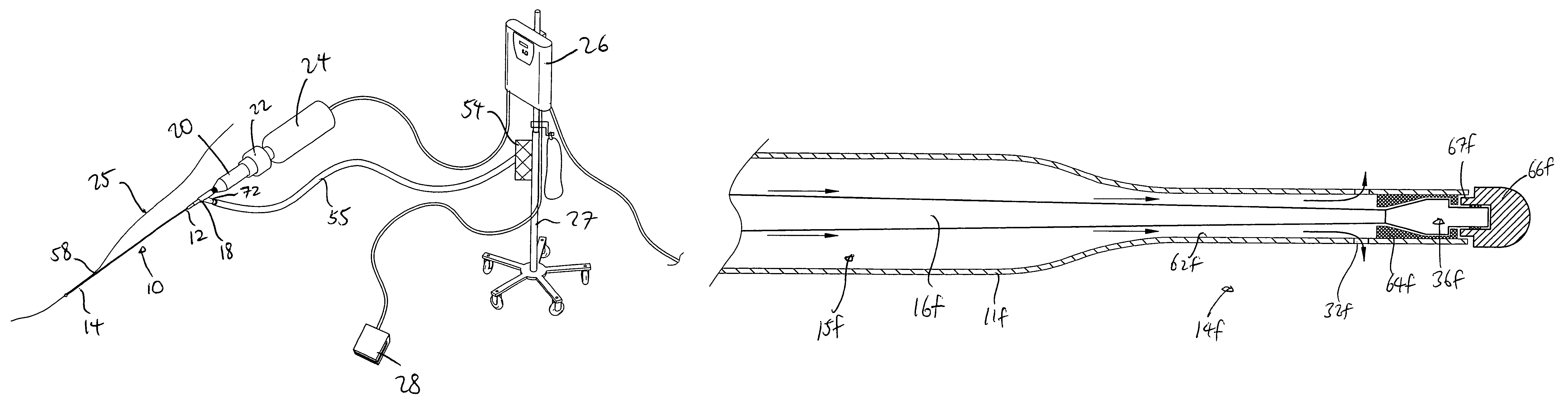 Ultrasound catheter having protective feature against breakage