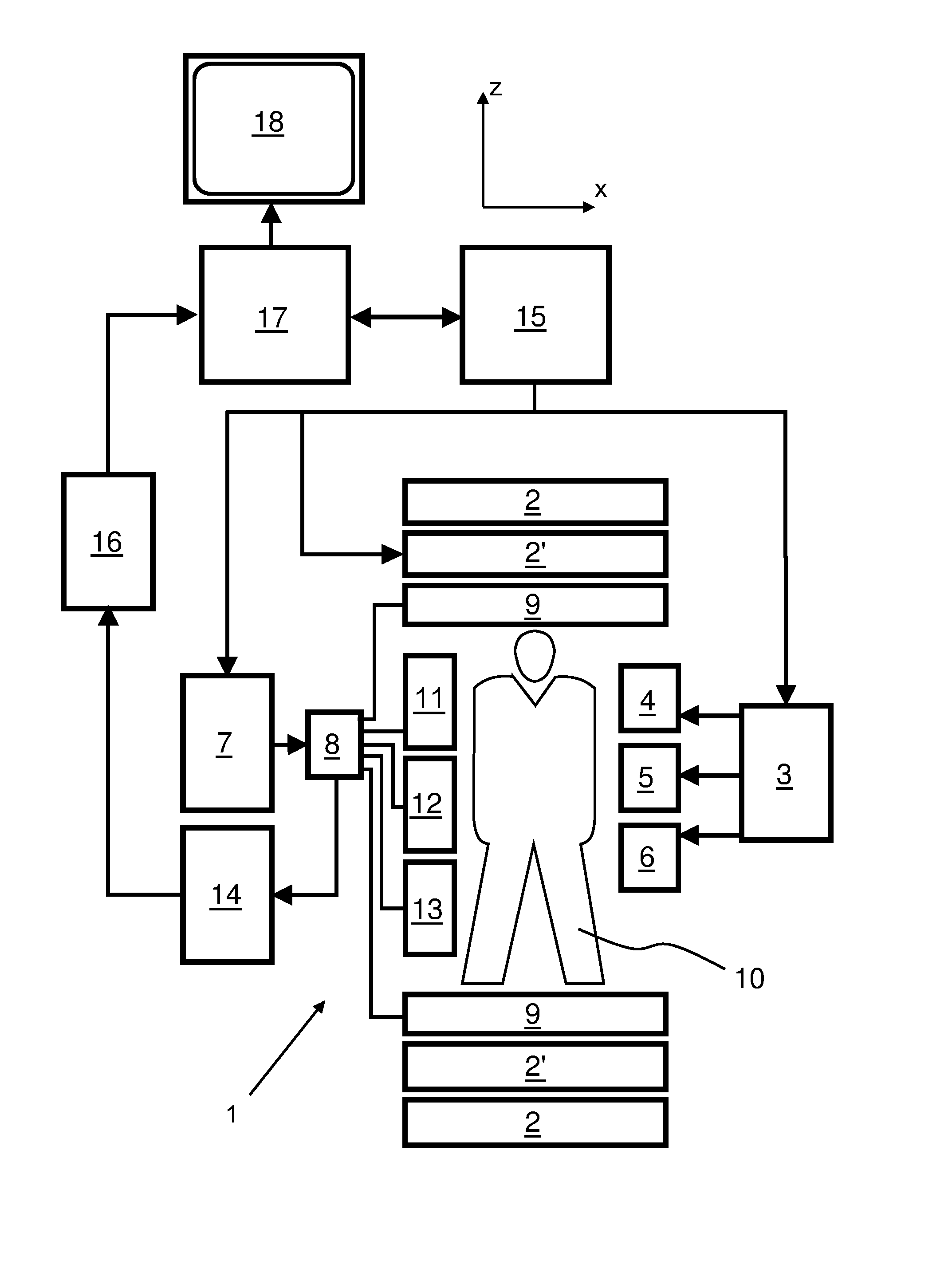 Parallel MRI with bo distortion correction and multi-echo dixon water-fat separation using regularised sense reconstruction