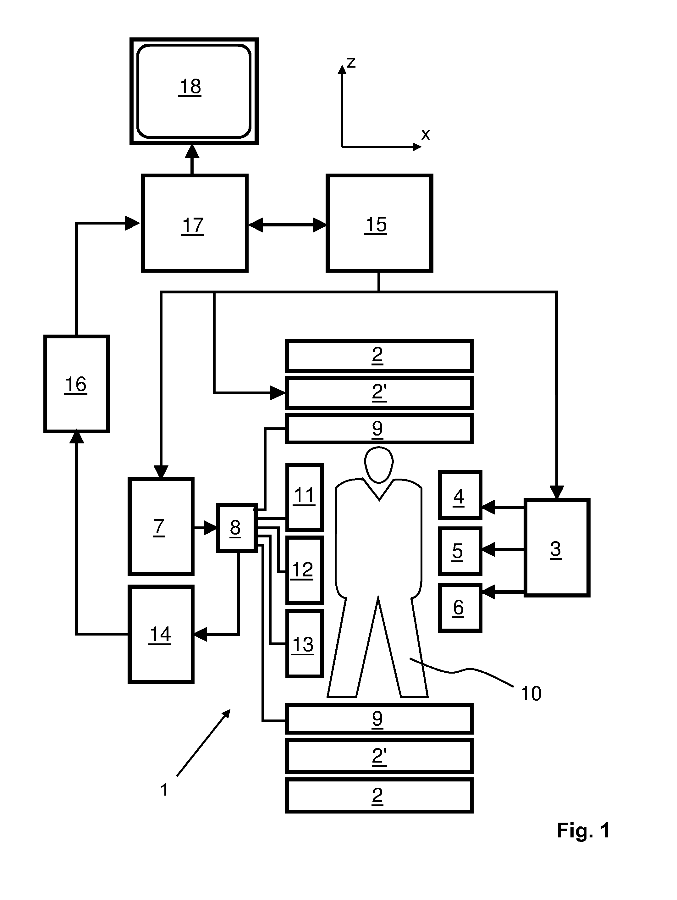 Parallel MRI with bo distortion correction and multi-echo dixon water-fat separation using regularised sense reconstruction