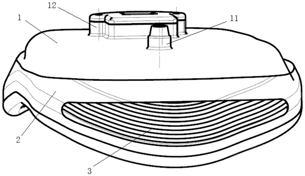 Telescopic funnel chest correction device and preparation method thereof