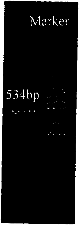 Dectin-1 fusion protein expression vector and application thereof