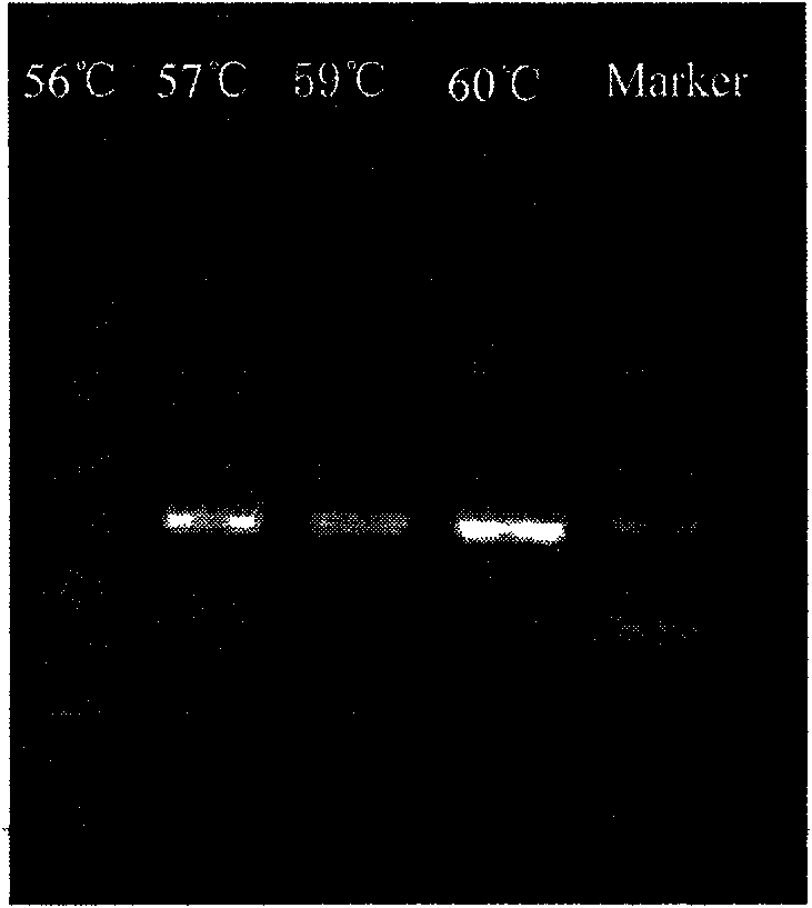 Dectin-1 fusion protein expression vector and application thereof