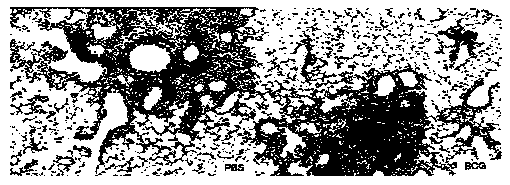 Immunologic adjuvant and vaccine containing immunologic adjuvant