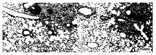 Immunologic adjuvant and vaccine containing immunologic adjuvant