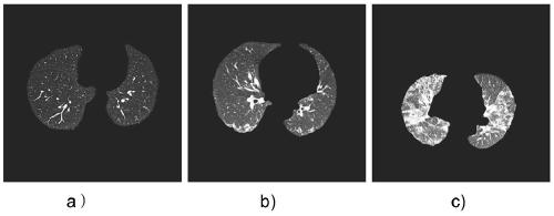 Lung tissue dissimilation degree judgment method and device