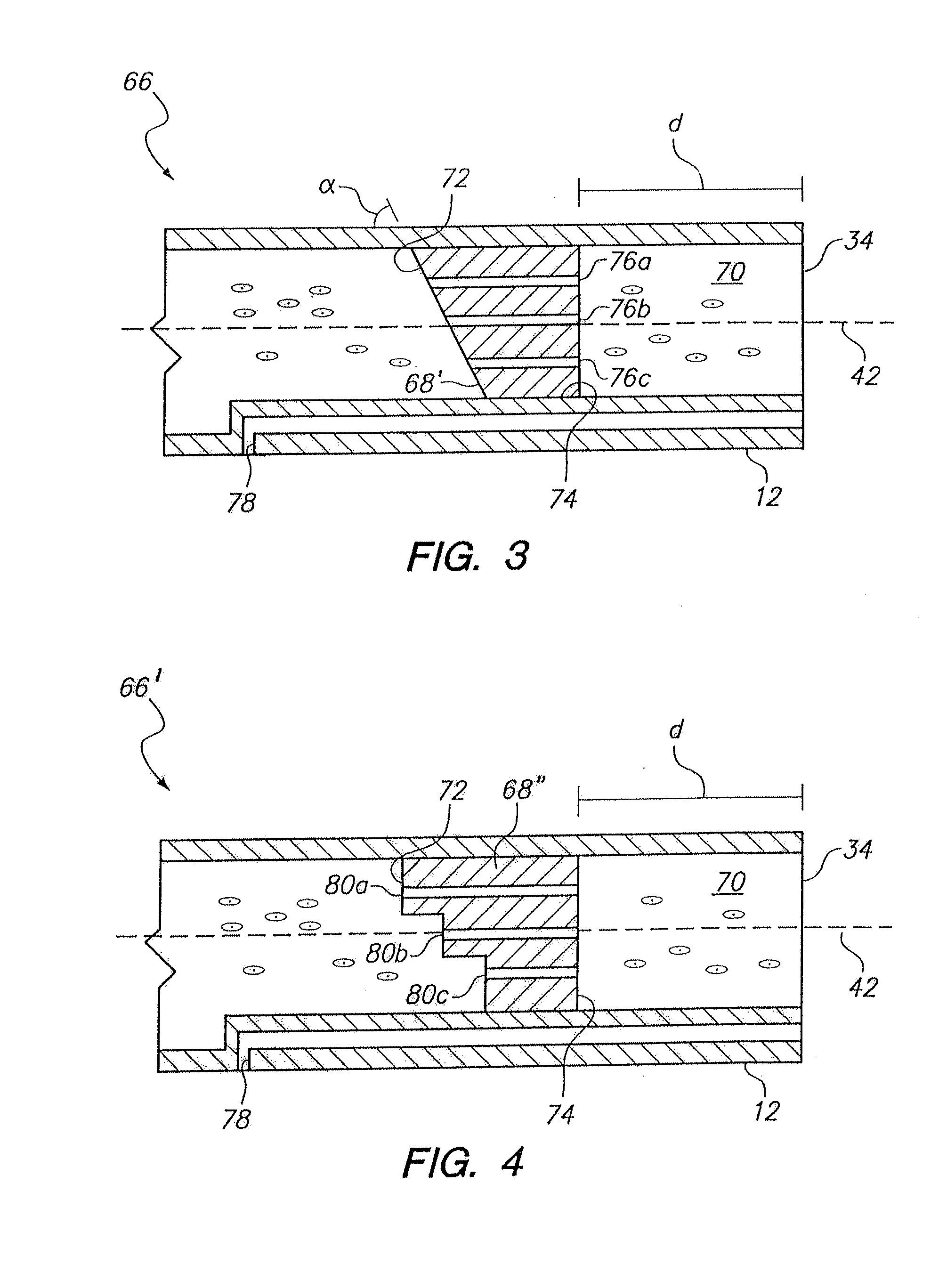 Infusion Catheter Tip for Biologics with Reinforced External Balloon Valve