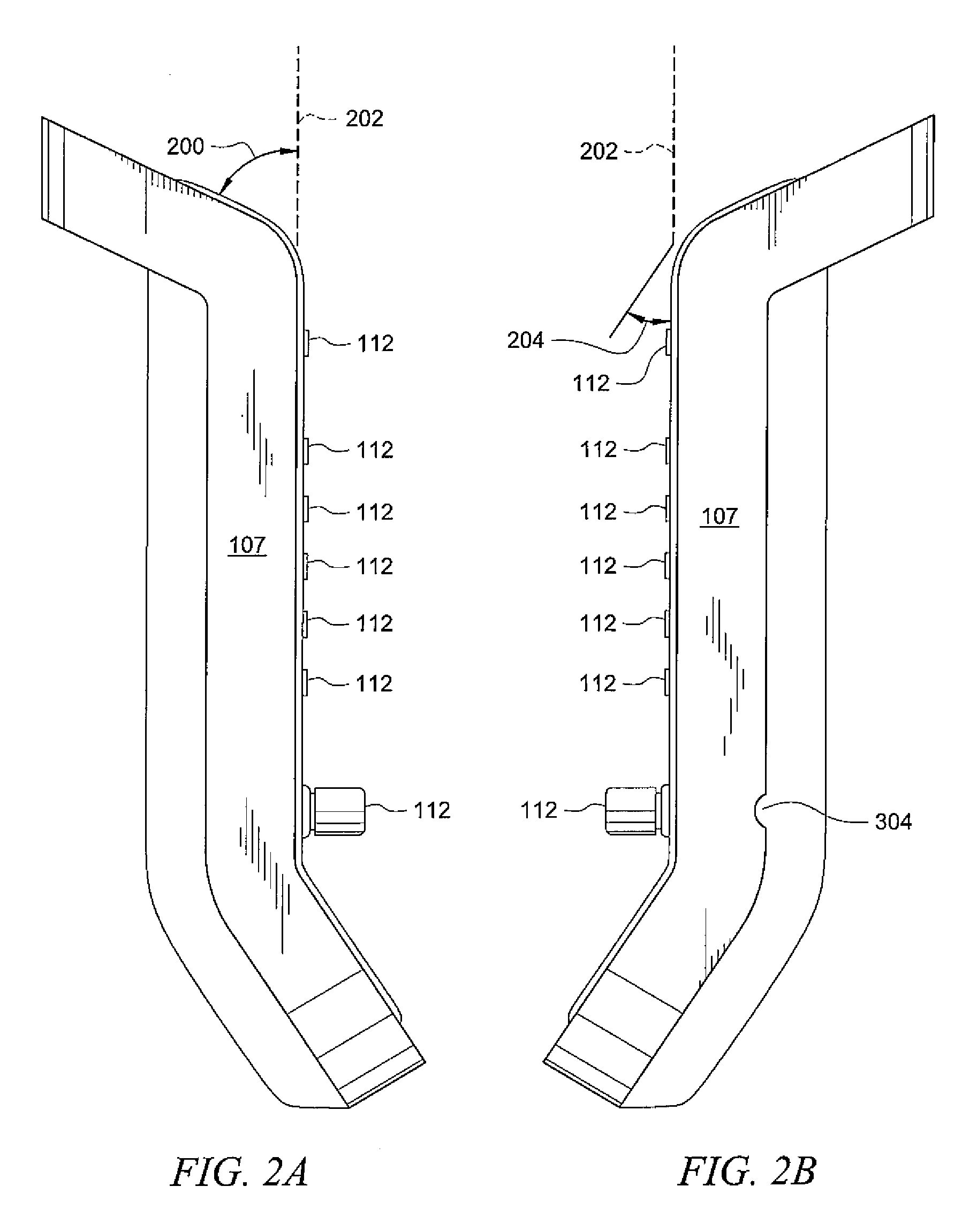 Enhanced ultrasound system