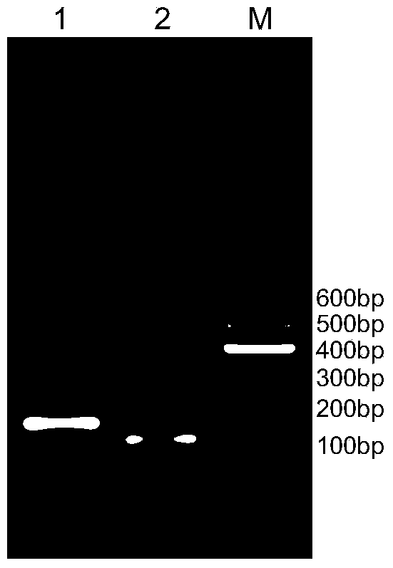 Method for detecting resistance of diamondback moth to Bt insecticidal protein Cry1Ac based on ABCC1 gene and kit thereof