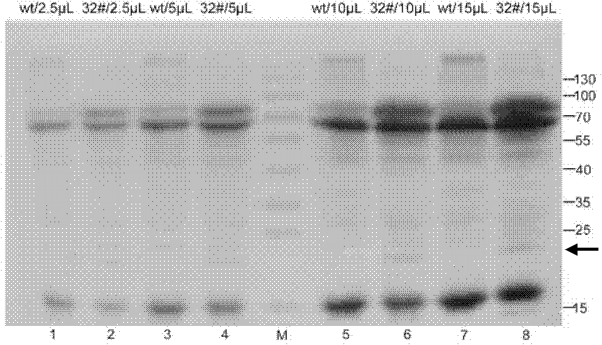 Method for constructing anti-mammitis transgenic mouse model and special vector for method